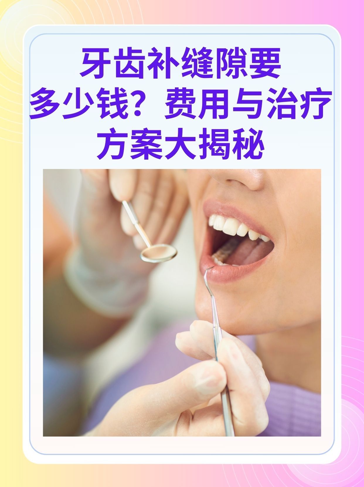 海南补牙医保可以报销吗(补牙医保可以报销吗 哪些可以报销呢)